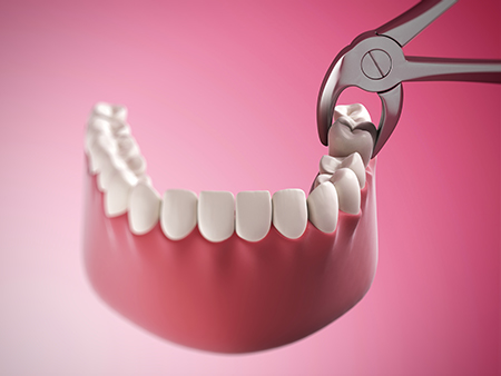 Plum Dental Associates | Root Canals, Dental Cleanings and Extractions